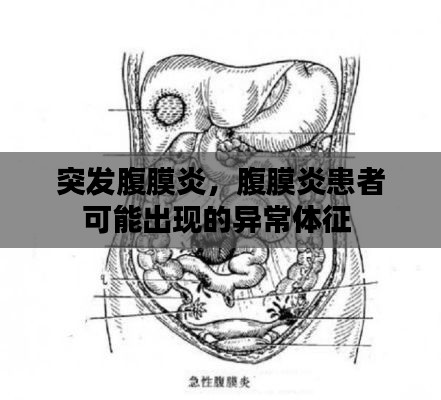 突发腹膜炎,腹膜炎患者可能出现的异常体征